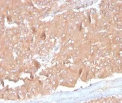 CCL8/MCP-2 Mouse anti-Human, Clone: CCL8/3686, Novus Biologicals:Antibodies:Primary